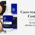 ¿Que es Crema para estrías en cosmetica?